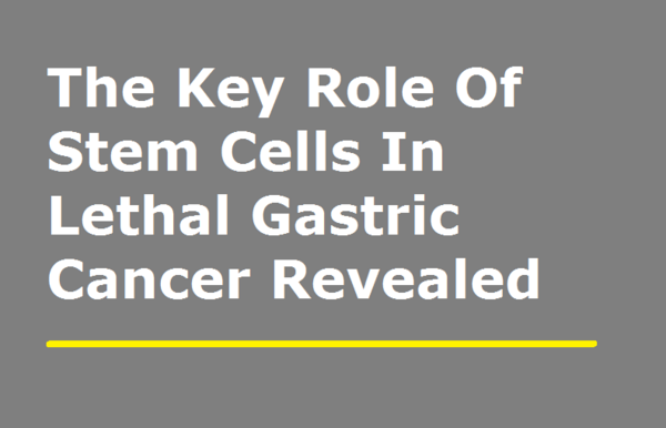 The Key Role Of Stem Cells In Lethal Gastric Cancer Revealed