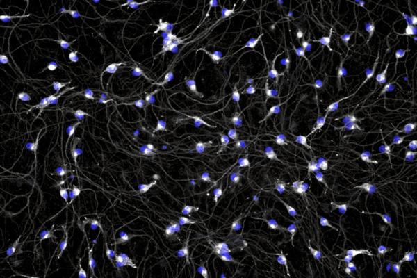Bristol Myers Squibb Grants $25M for …