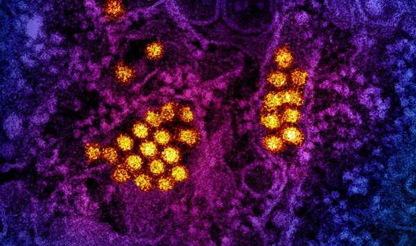 ImmunoPrecise AI Discovers Pan-Serotype Dengue Vaccine …