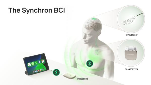 Synchron Becomes First to Achieve Native Thought-Control …