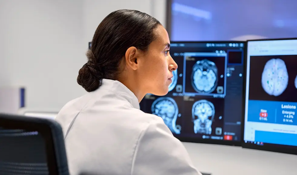 GE HealthCare to Acquire icometrix for AI-Powered Brain MRI Solutions