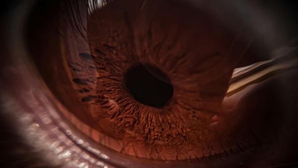 BioAge to Begin Mid-2026 Trial of Oral NLRP3 Inhibitor in Diabetic Macular Edema