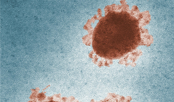 In an AI-Enabled ALS Study, Digital Twins …