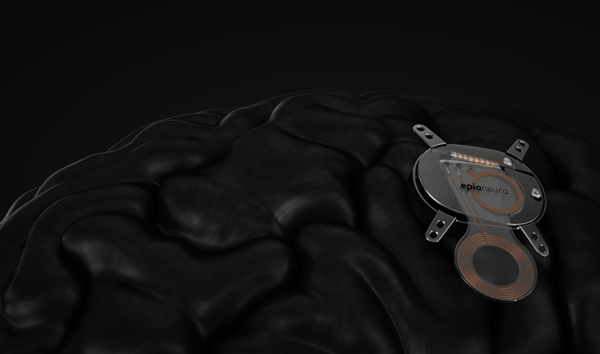 Epia Neuro Wants to Decode Brain's Movement Intentions After Stroke