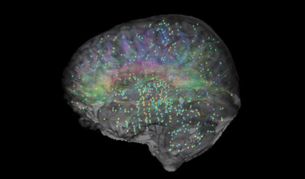 No Clear Winner: 7-Year Brain Study Tests Rival Theories of Consciousness