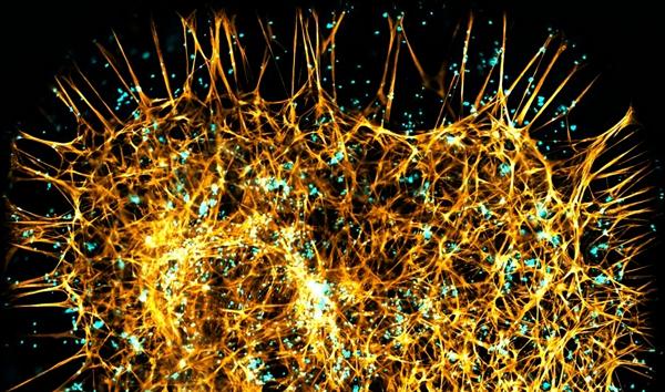 Crown Bioscience Shows 3D Bone Marrow …