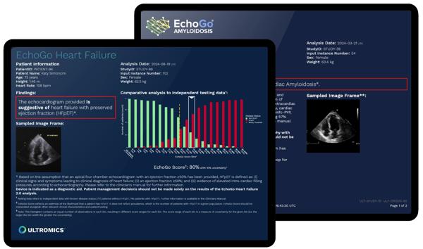 Ultromics Gets $55M to Spot Hidden Heart …