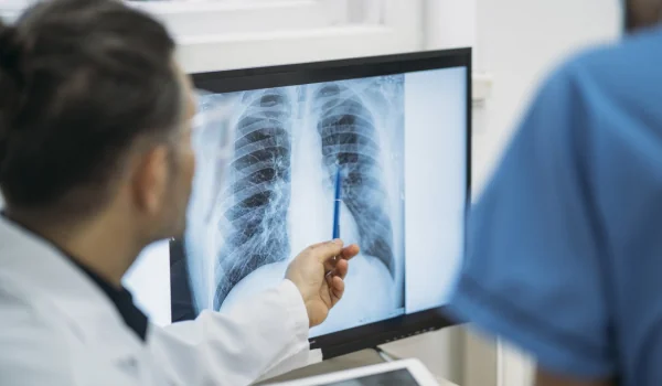 AI Integration Advances Lung Fibrosis Patient …