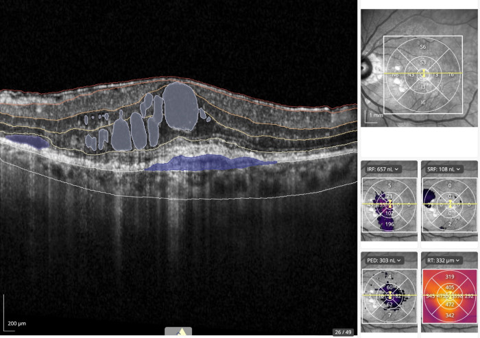 RetinAI drug discovery toolset