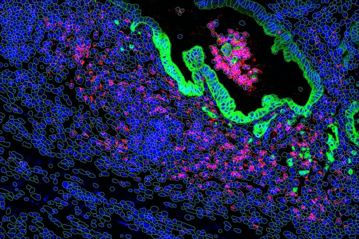 Spatial biology maps biological molecules to their location within a tissue