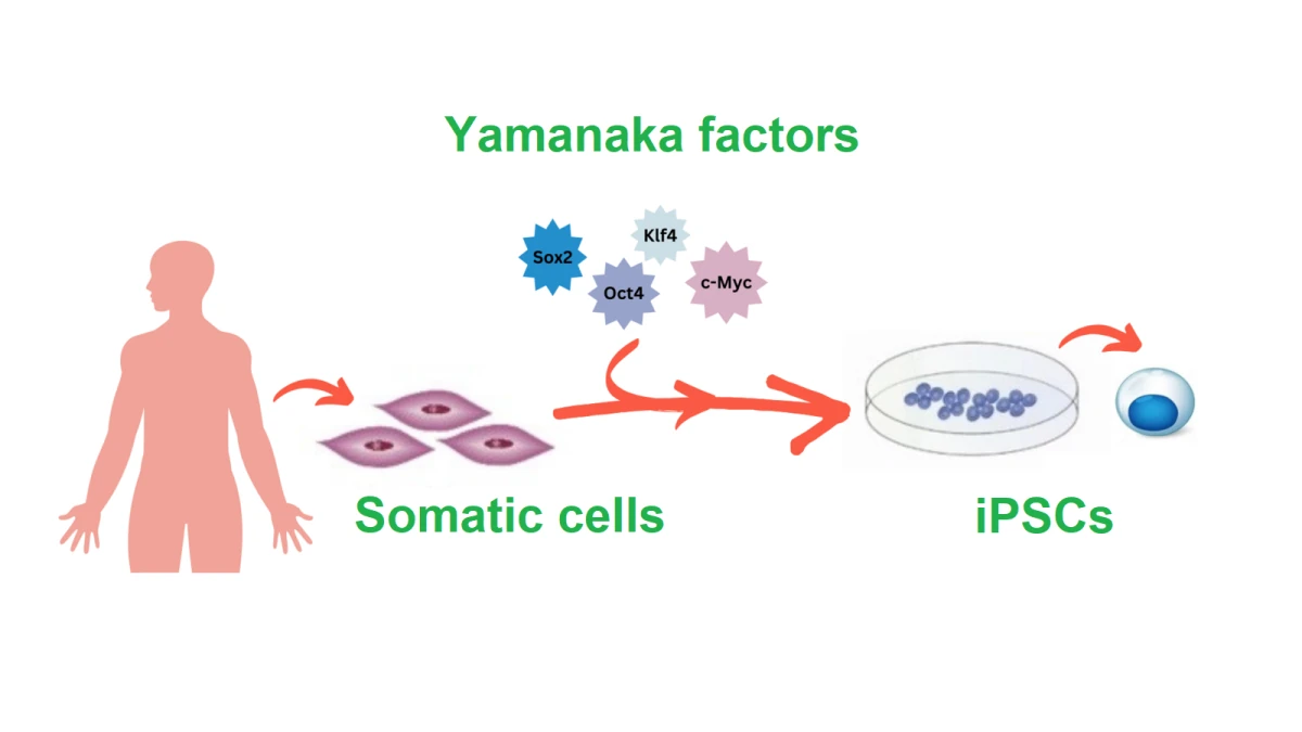 Yamanaka factors
